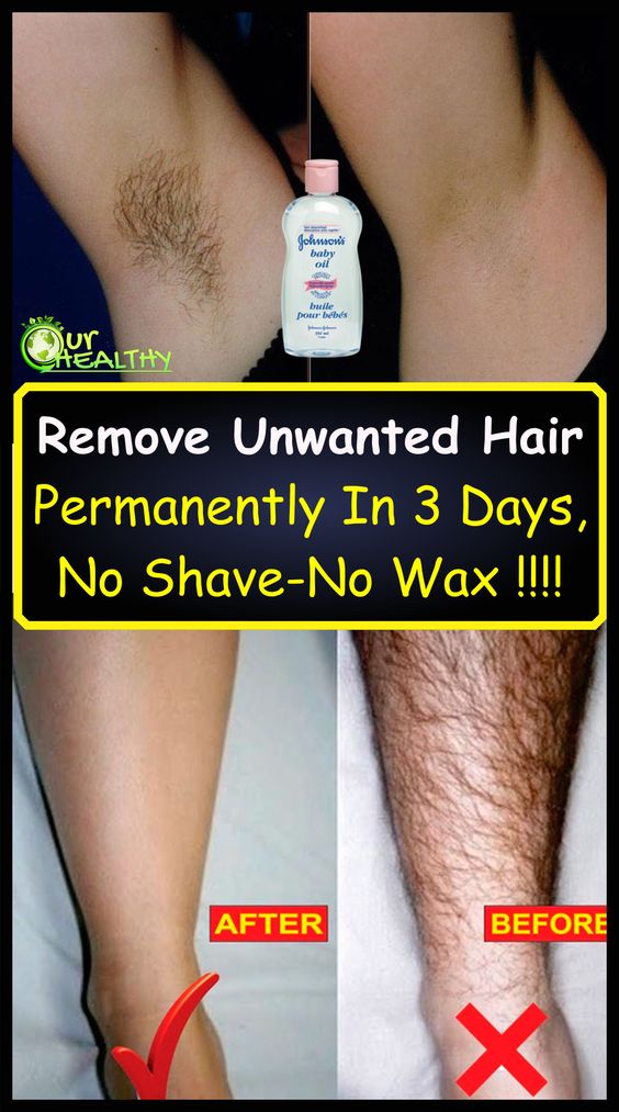 How To Remove Body Hair Permanently Without Waxing Or Shaving Quoqlee 