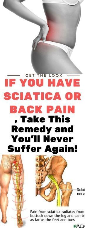 If You Have Sciatica or Back Pain, Take This Remedy And You’ll Never ...